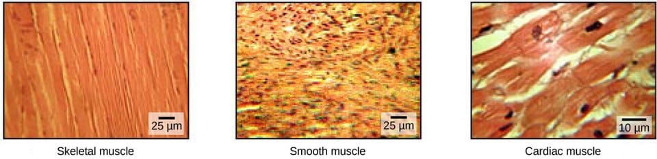 Three micrographs showing skeletal, smooth and cardiac muscle.