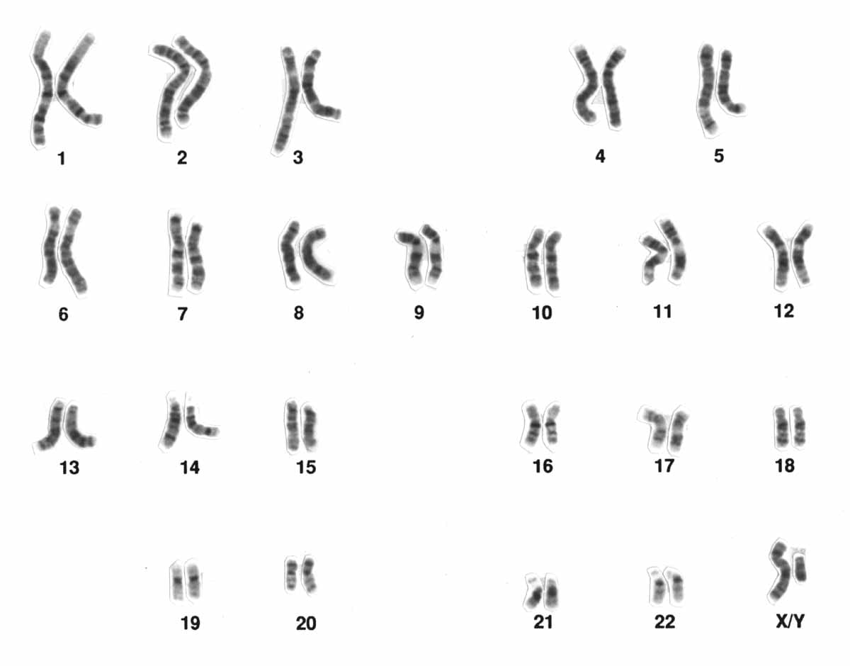 46 chromosomes arranged in pairs from largest to smallest.
