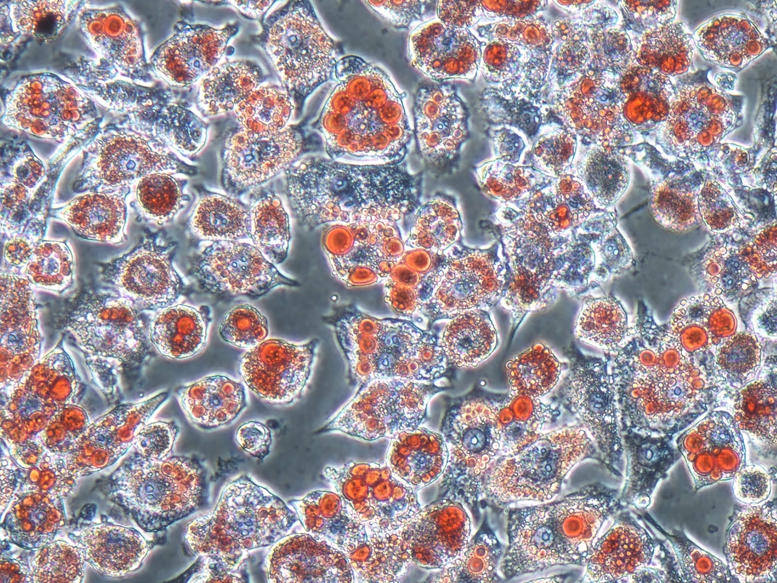 A microgram showing grey cells with lots of red bubbles within them.